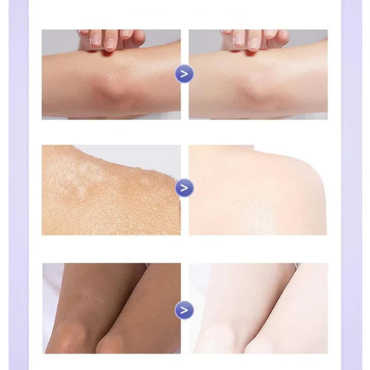 Omenfee - Instant Skin Whitening Gel - Buy 1 Get 1 Free