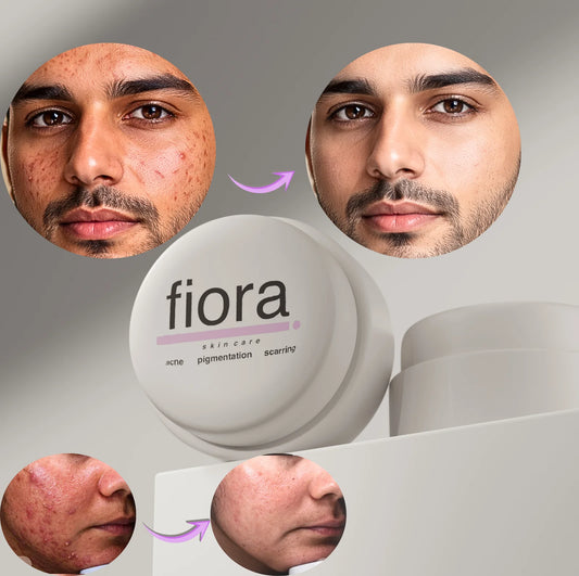 Fiora Repair Cream