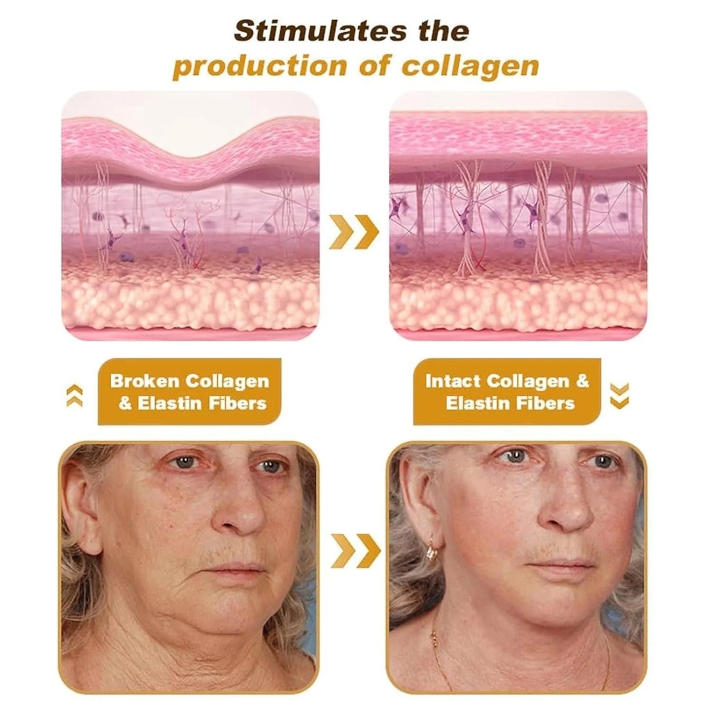 Botox Wrinkle Repair Cream – Buy 1 Get 1 Free