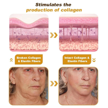 Botox Wrinkle Repair Cream – Buy 1 Get 1 Free